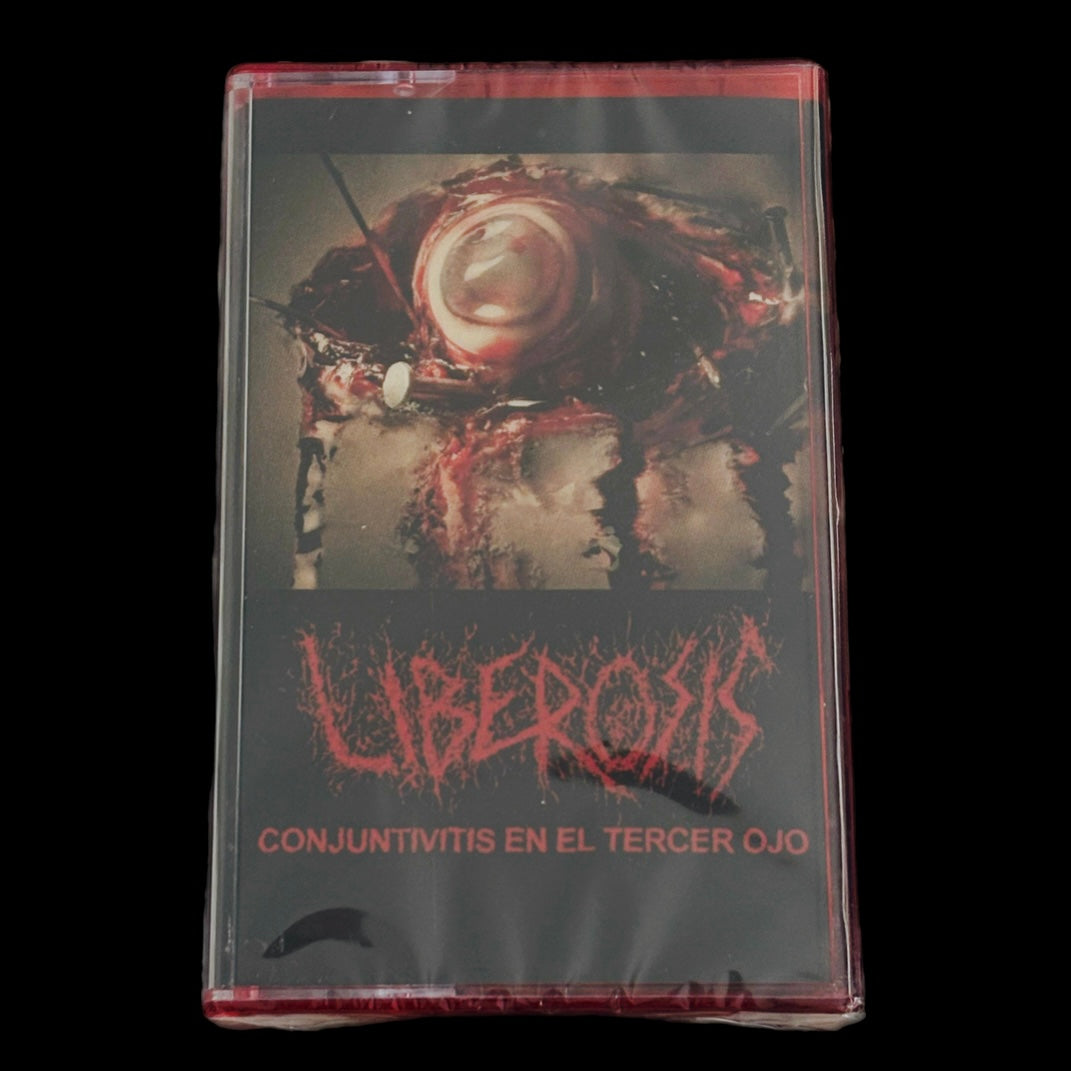 Uberosis Cassette Tape